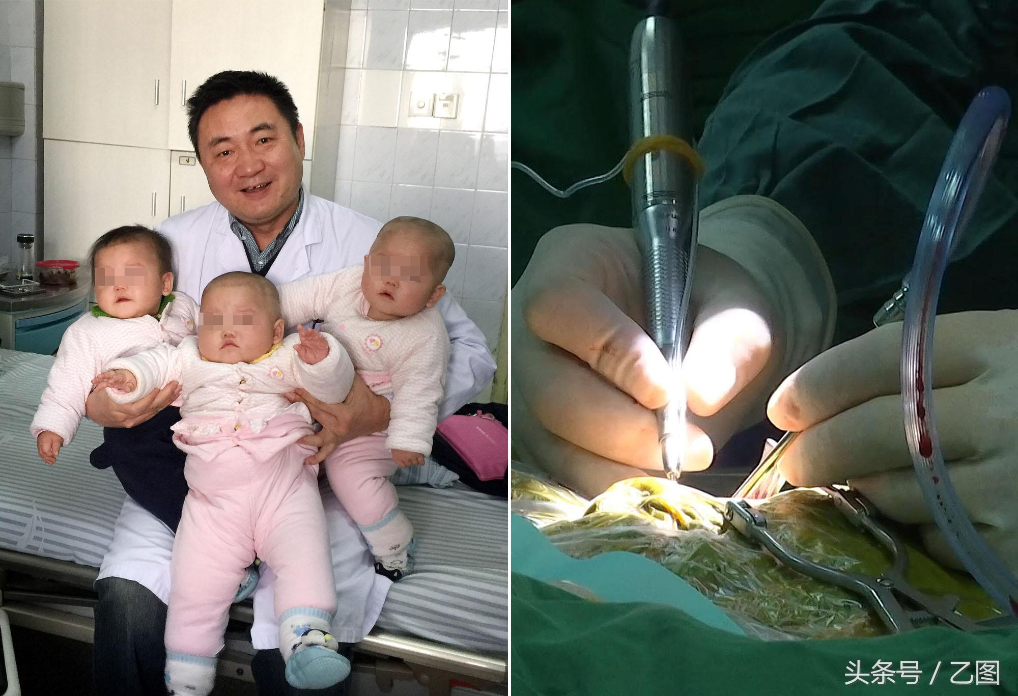 最新人工耳蜗,听见世界的每一次呼唤,拥抱变化带来的自信与成就