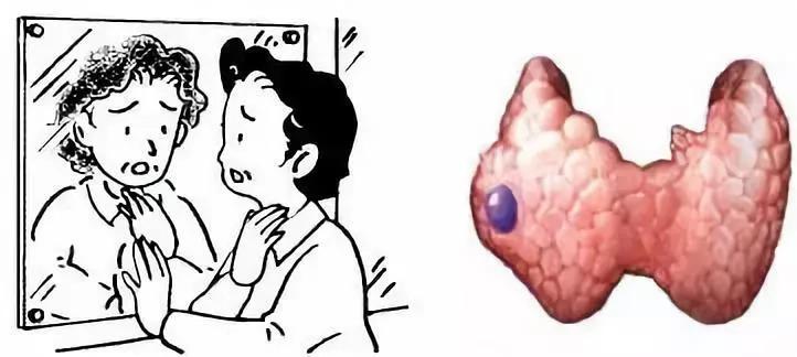 课程直播穿刺,探索医疗技术的透明之窗