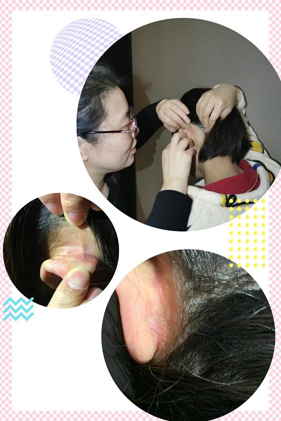 压疮护理新策略,提升患者舒适度与治疗效果的关键