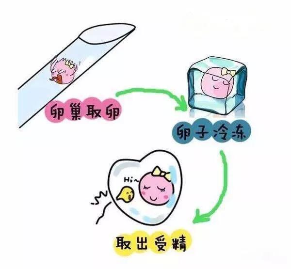 明星冻卵,步骤指南与须知