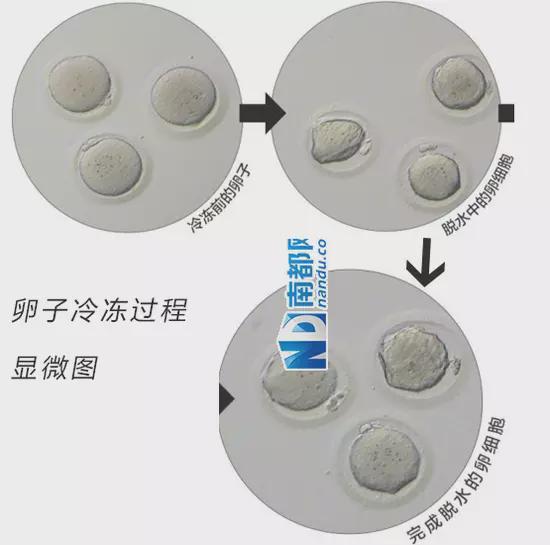 明星冻卵,步骤指南与须知