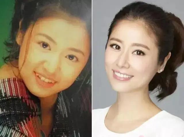 有小虎牙的明星,星光下的温暖日常