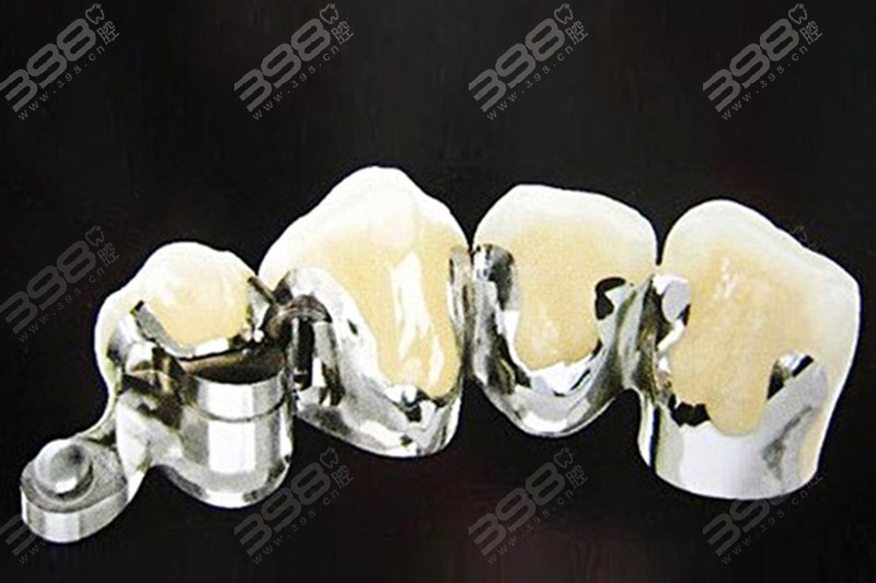 附着体义齿价格,深入解析与观点阐述