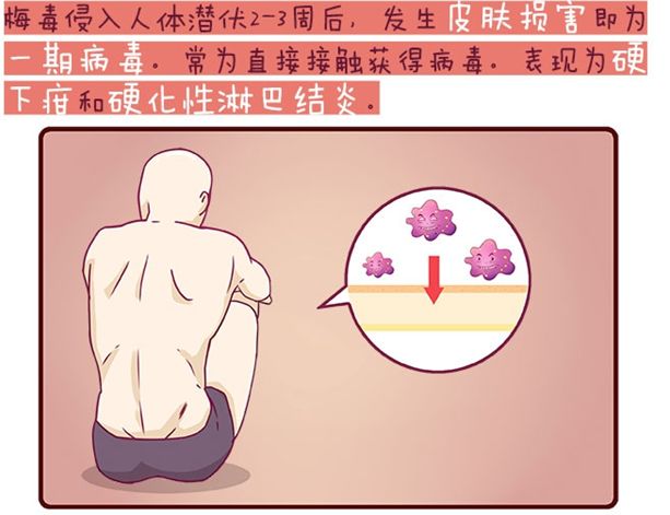 梅毒的最新治疗方法,小巷深处的秘密小店